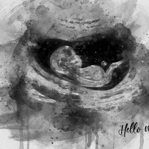 Personalised Gender Reveal Canvas Ultrasound Art Gift for Baby Shower Gift for Mom Keepsake Sonogram Watercolor Print Pregnancy Baby Scan