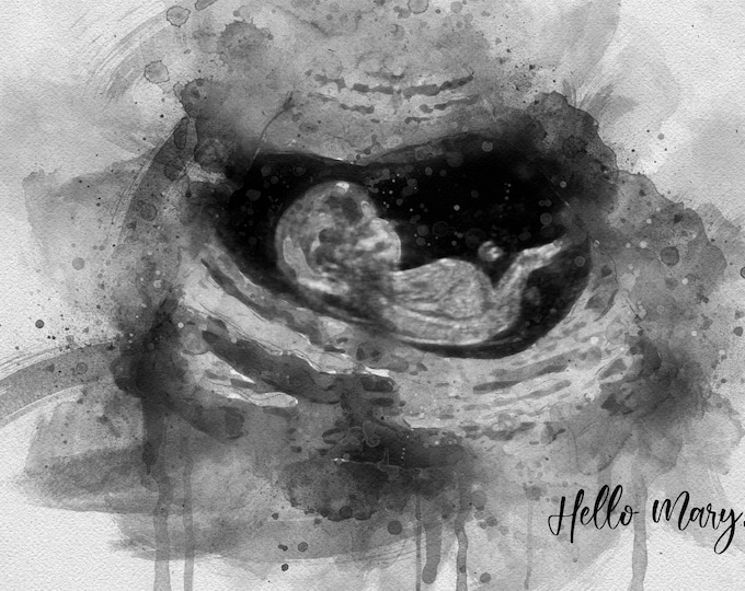 Personalised Gender Reveal Canvas Ultrasound Art Gift for Baby Shower Gift for Mom Keepsake Sonogram Watercolor Print Pregnancy Baby Scan