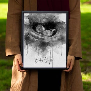 Watercolor Sonogram Print | Portrait from Photo | Baby Ultrasound Art | Baby Shower Gift | Gender Reveal | Pregnancy Gift