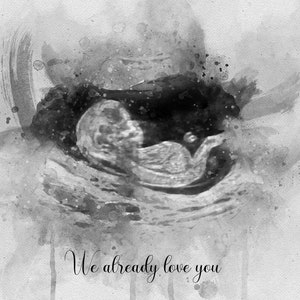 Baby Shower Gift Customized Gender Reveal Art Ultrasound Keepsake Gift for Mom to be Sonogram Keepsake Watercolor Print Pregnancy Baby Scan