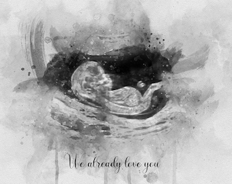 Baby Shower Gift Customized Gender Reveal Art Ultrasound Keepsake Gift for Mom to be Sonogram Keepsake Watercolor Print Pregnancy Baby Scan