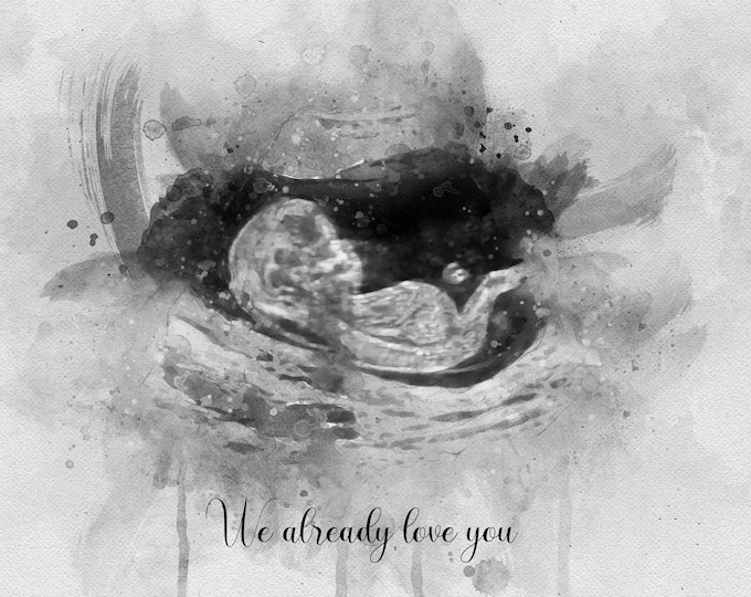Baby Shower Gift Customized Gender Reveal Art Ultrasound Keepsake Gift for Mom to be Sonogram Keepsake Watercolor Print Pregnancy Baby Scan