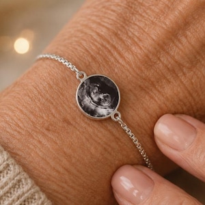 May include: A silver-toned chain bracelet featuring a circular pendant with a black and white ultrasound image embedded in the centre. The bracelet has a delicate link design and is secured around the wrist with a thin, adjustable metal chain.