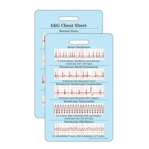 EKG Nursing Reference Cards | Nursing Badge Cards | Vertical