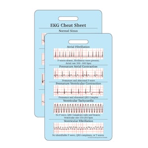 EKG Cheatsheet | EKG Interpretation Reference Card | Dysrhythmia | Badge Buddy | Vertical Layout