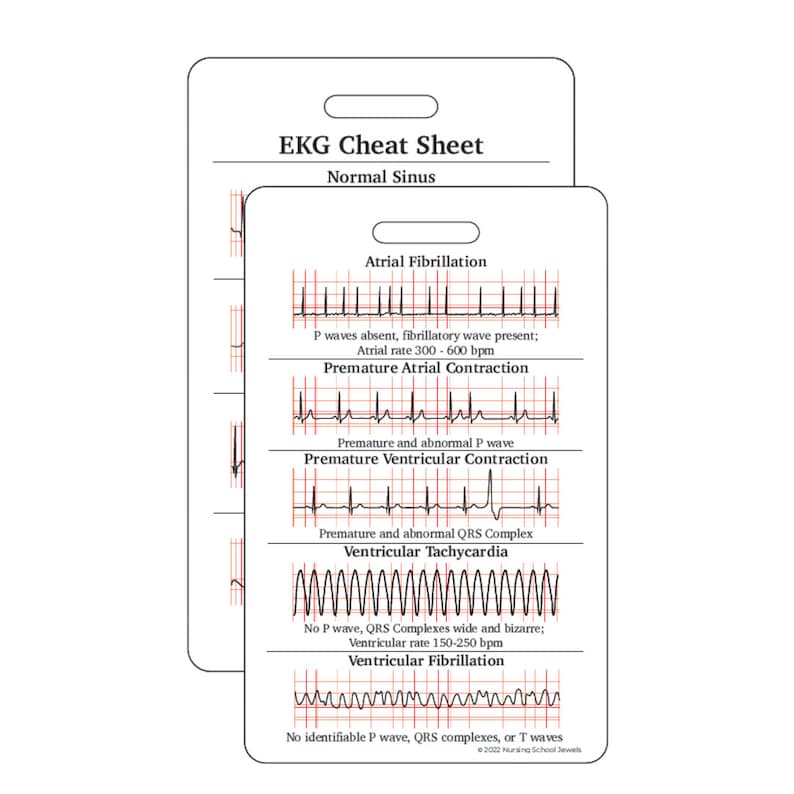 EKG Cheatsheet EKG Interpretation Reference Card - Etsy