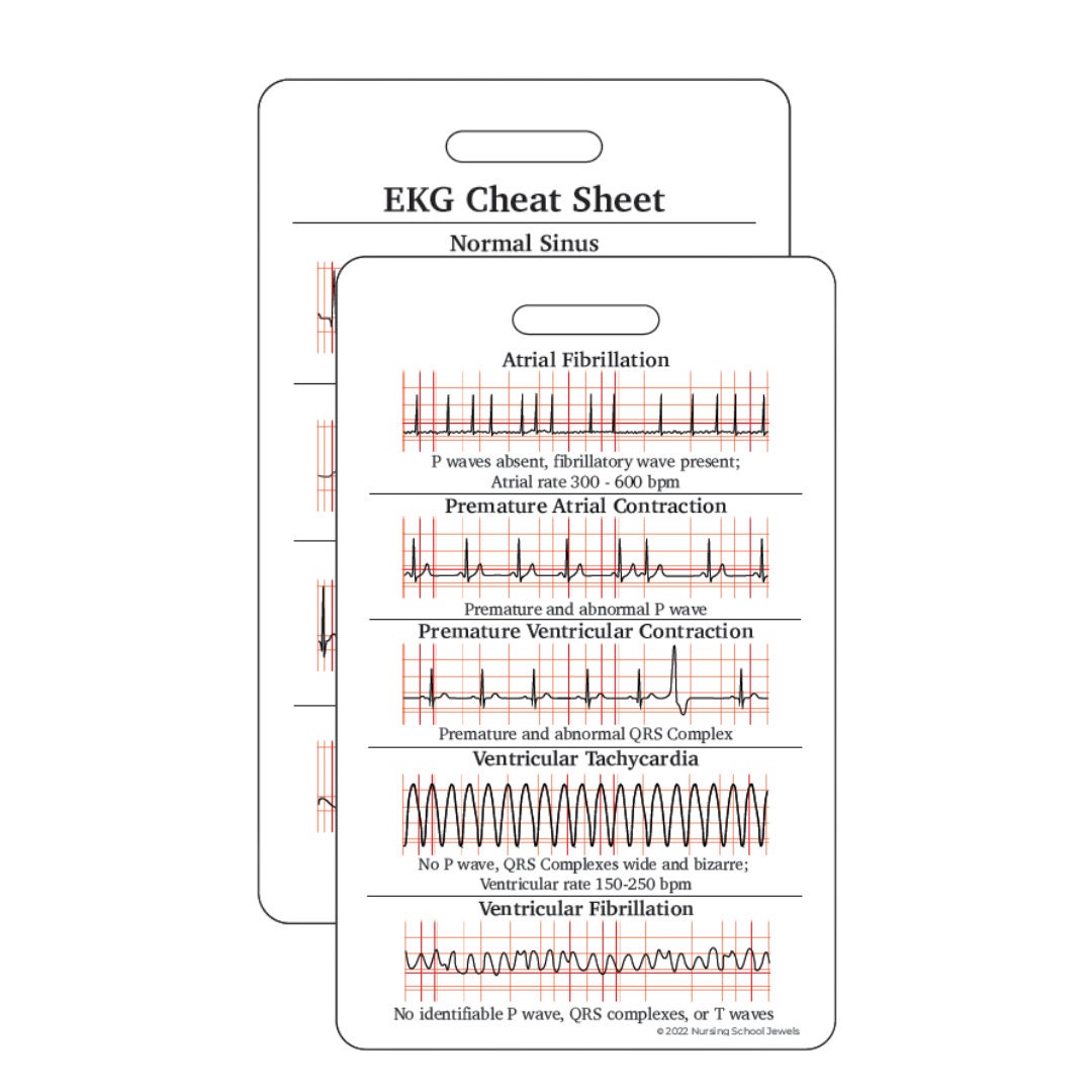EKG Nursing Reference Cards | Nursing Badge Cards | Vertical - Etsy