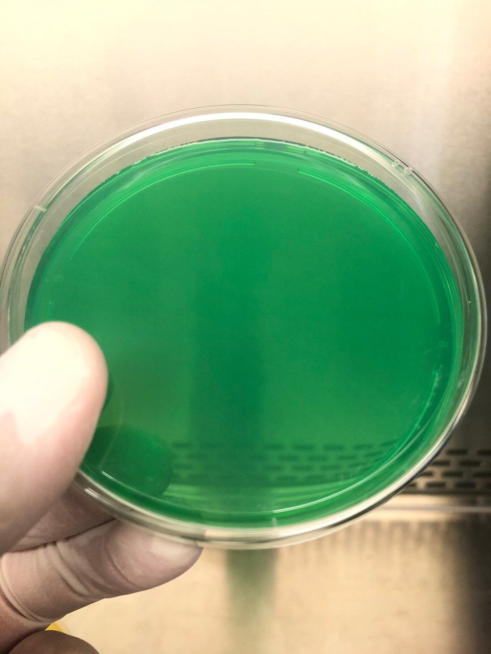 20 Custom Color Pre-poured Agar Petri Dishes Polystyrene 100mm | Etsy