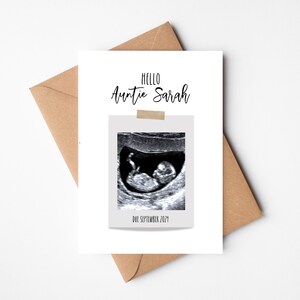 Personalisierte Schwangerschaftansage Karte | Sonograph Foto | Schwangerschaft offenbaren | Baby-Ankündigungskarte | Ultraschall | Baby Scan