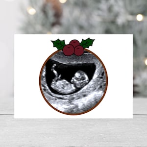 Stampa ecografia di Natale / Stampa ecografia di Natale / Stampa immagine scansione budino di Natale / Cartolina regalo / Biglietto di annuncio