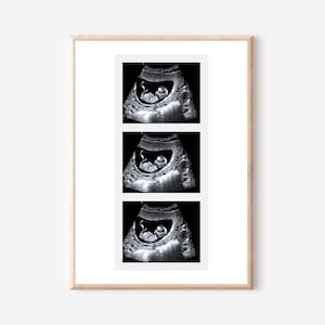 Tira de ultrassom personalizada | Tira de fotos | Cabine de fotos de digitalização | Sonografia | Lembrança de ultrassom | Presente de chá de bebê | Anúncio de gravidez