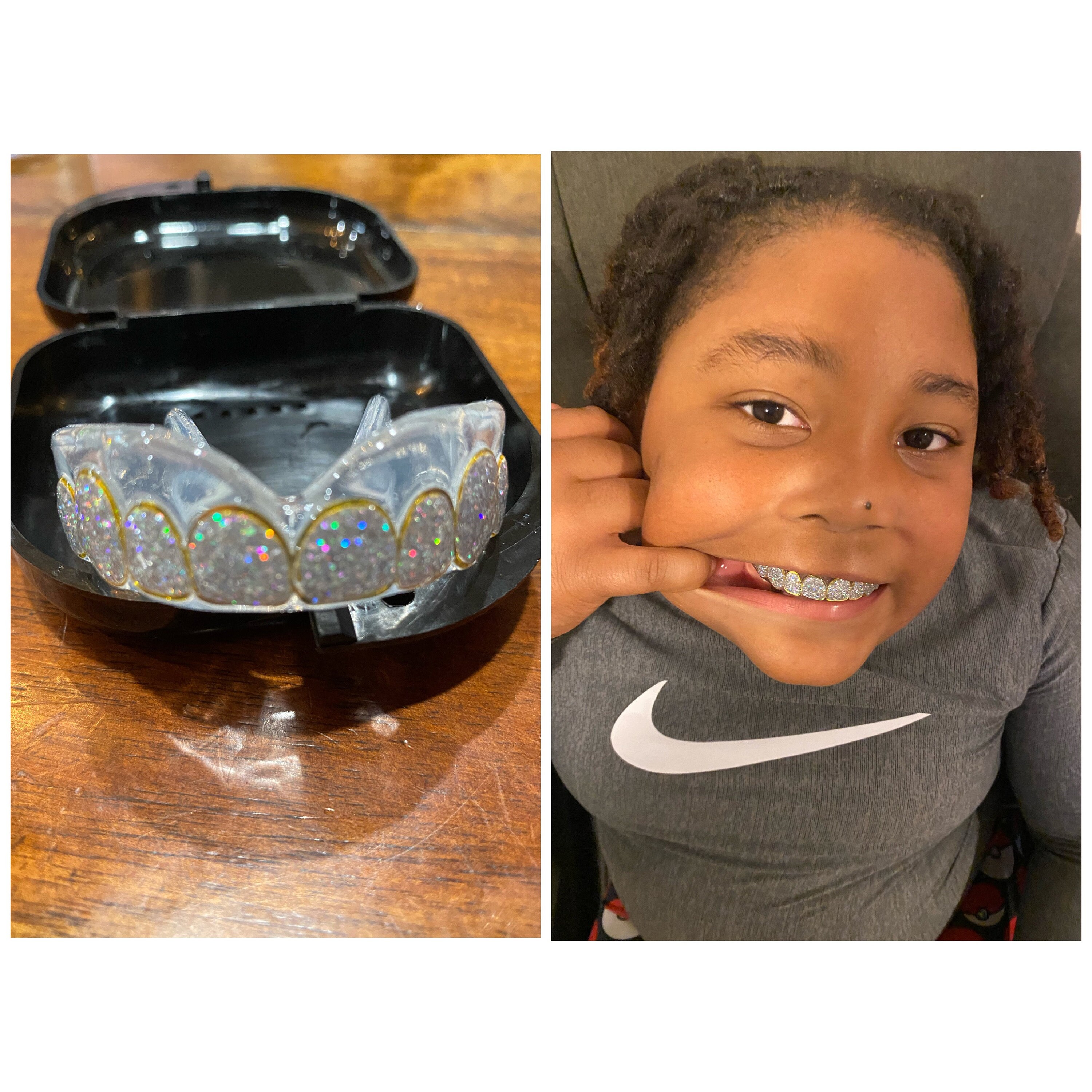 Grill Mouthpiece Designed For Sports