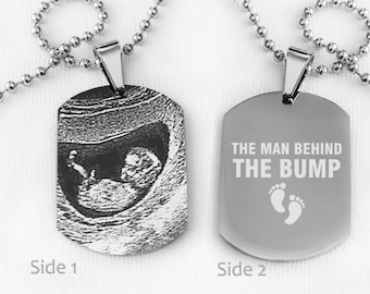 Photo Engraved Personalised Ultrasound Baby Scan Pendant, Custom Photo & Text Engraved Stainless Steel Pendant with Free Chain, Custom Gifts