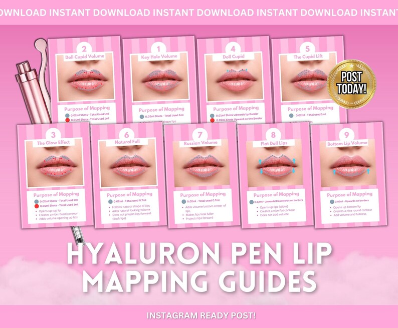 Hyaluron Pen Lip Mapping, Lip Maps, Russian Lips, Keyhole Pout, Lip ...