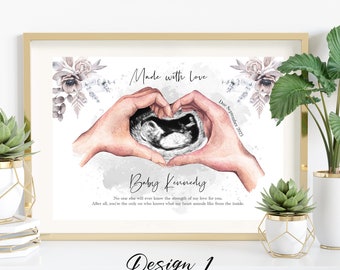 Personalised Pregnancy Scan Print Gift, Baby Scan Photo Print, Baby Shower Ultrasound, Baby Girl Boy, Baby Scan Keepsake, Mum to be gift