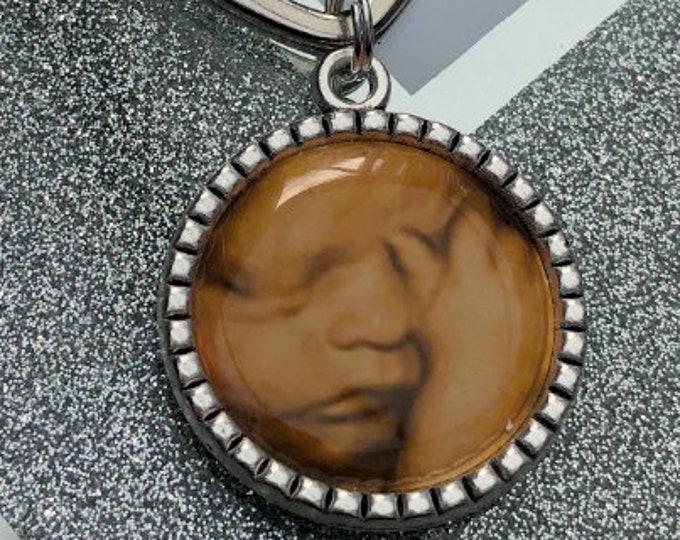 Baby Scan Ultrasound Keyring Keepsake Gift/New parents/Dad/Mum to be/Pregnancy/Grandparents/4D ultrasound/Double sided/Little Peek/Photo/