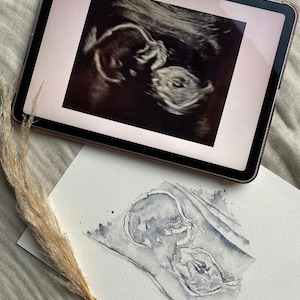 Baby Ultrasound Art, Nursery Decor, Personalised Art, Ultrasound scan, Sonogram Art, Baby Shower Gift, New baby, Welcome Baby, Gift for mums imagem 6