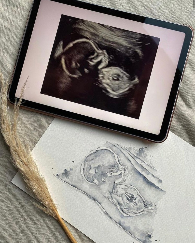 Baby Ultrasound Art, Nursery Decor, Personalised Art, Ultrasound scan, Sonogram Art, Baby Shower Gift, New baby, Welcome Baby, Gift for mums image 6