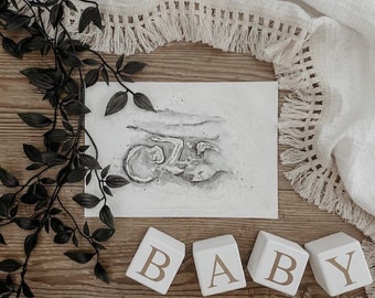 Watercolor Ultrasound Art: Personalized Baby Scan Nursery Decor