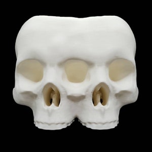 May include: A white plaster sculpture of two conjoined human skulls. The skulls are facing forward and have visible eye sockets, nasal cavities, and teeth.