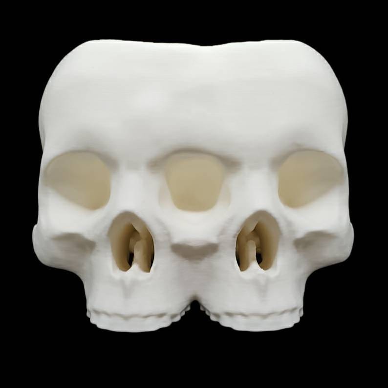 May include: A white plaster sculpture of two conjoined human skulls. The skulls are facing forward and have visible eye sockets, nasal cavities, and teeth.