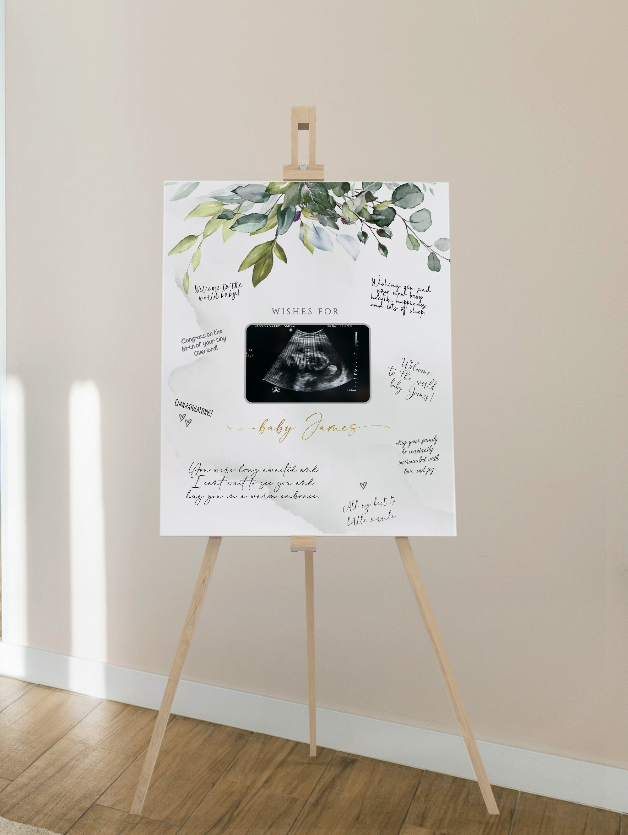 Printable Sonogram Ultrasound Guestbook Sonogram Photo Sign - Etsy