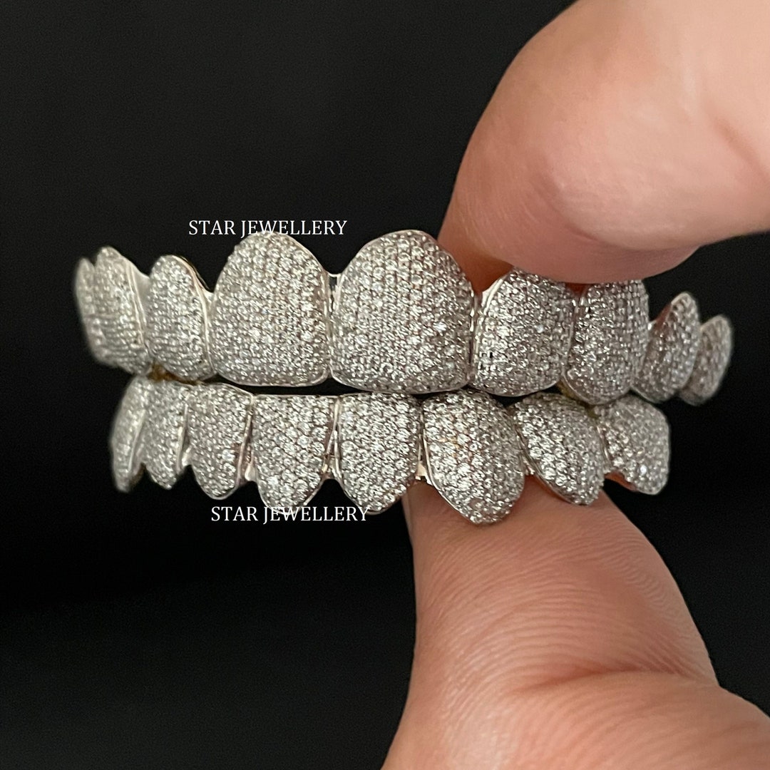 VVS Moissanite Grillz, Moissanite Diamond Grillz With 925 Sterling