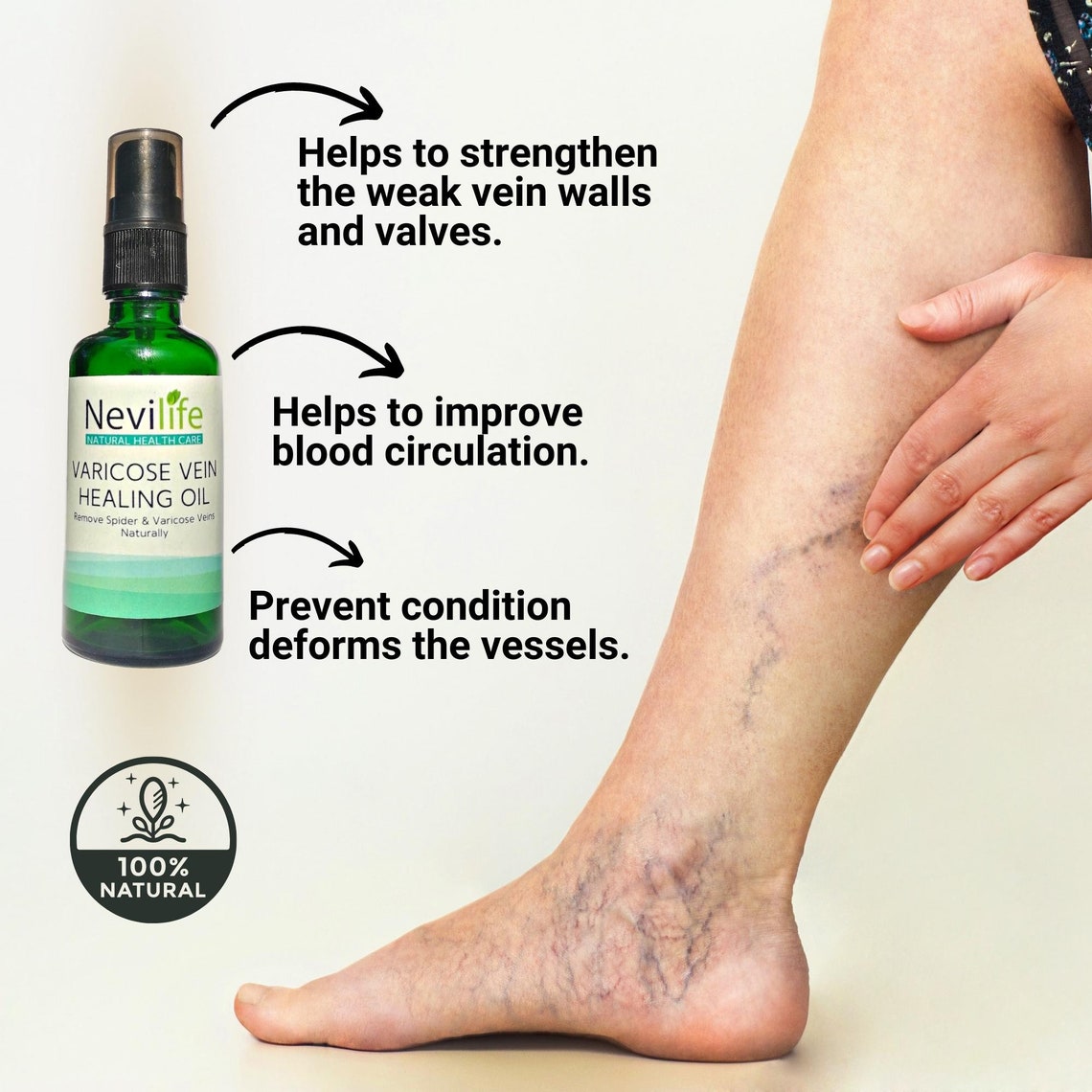 Varicose Vein Oil, Spider Vein Treatment, Organic Horse Chesnut Oil
