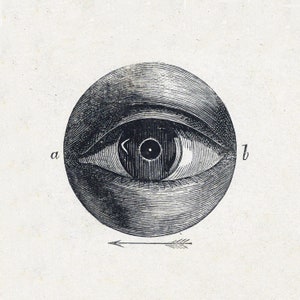ISAAC WEISSENBRUCH Human Eye with Abnormality Anatomy Original in Rijksmuseum Printed on Archival Textured Watercolour Paper C10x8ins