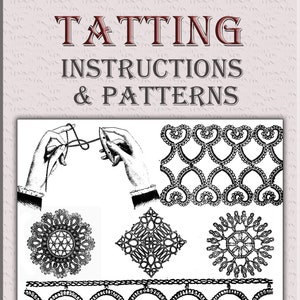 Star Book of Tatting Designs – A Tatting Pattern Book from 1935 – American  Thread Co. Star Book No. 2 – Free Download! – GreyGal's