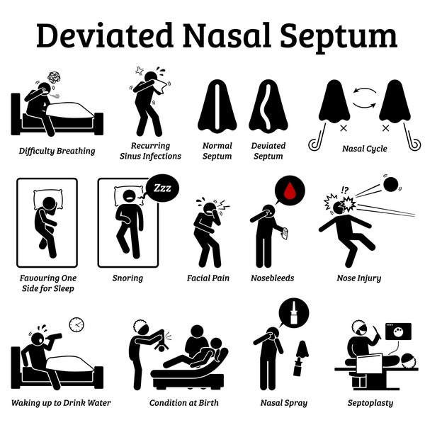 Deviated Nasal Septum Signs Symptoms Nose Problem Medical Condition Sinus Infection Snore Treatment Septoplasty Download Icon PNG SVG Vector