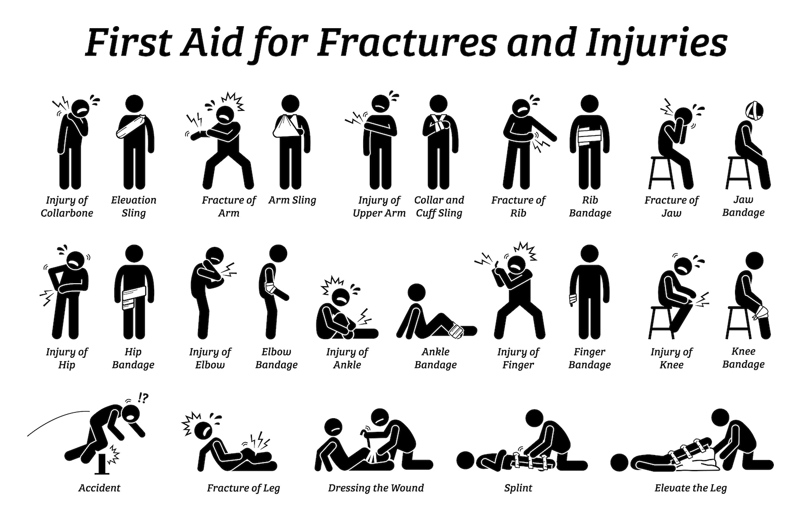 Types Fractures Broken Bones Royalty Free Vector Imag - vrogue.co