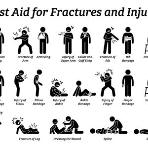 Eerste hulp fracturen Letsel Gebroken Bot Lichaam Deel Sling Bandage Elevation Technique Behandeling Pain Recovery Wound Splint PNG SVG Vector