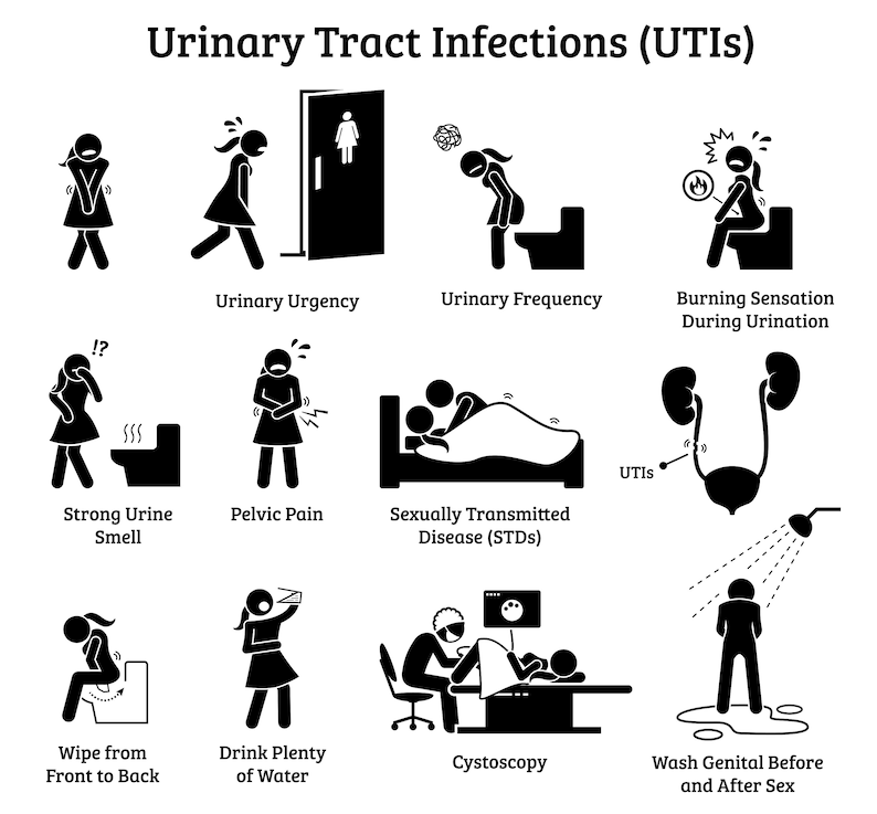 Urinary Tract Infection Uti Signs Bladder Inflammation Sex Etsy