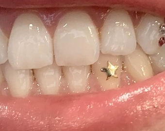 Twinkles 24k Yellow Gold Tooth Gems Small Star