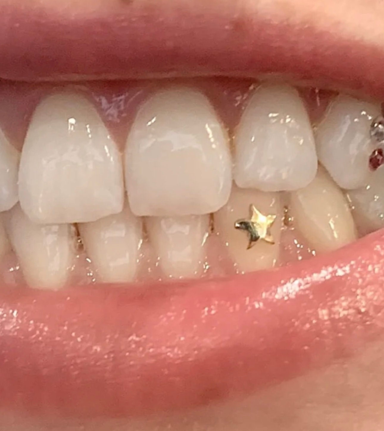 Limited Edition Crystal Shimmer swarovski for Tooth Gems 