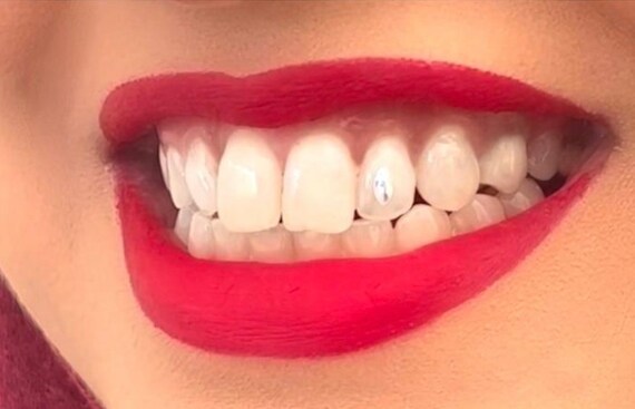 1440pcs Tooth Gems Preciosa® Crystal Pixie Chandelier CRYSTAL Lead