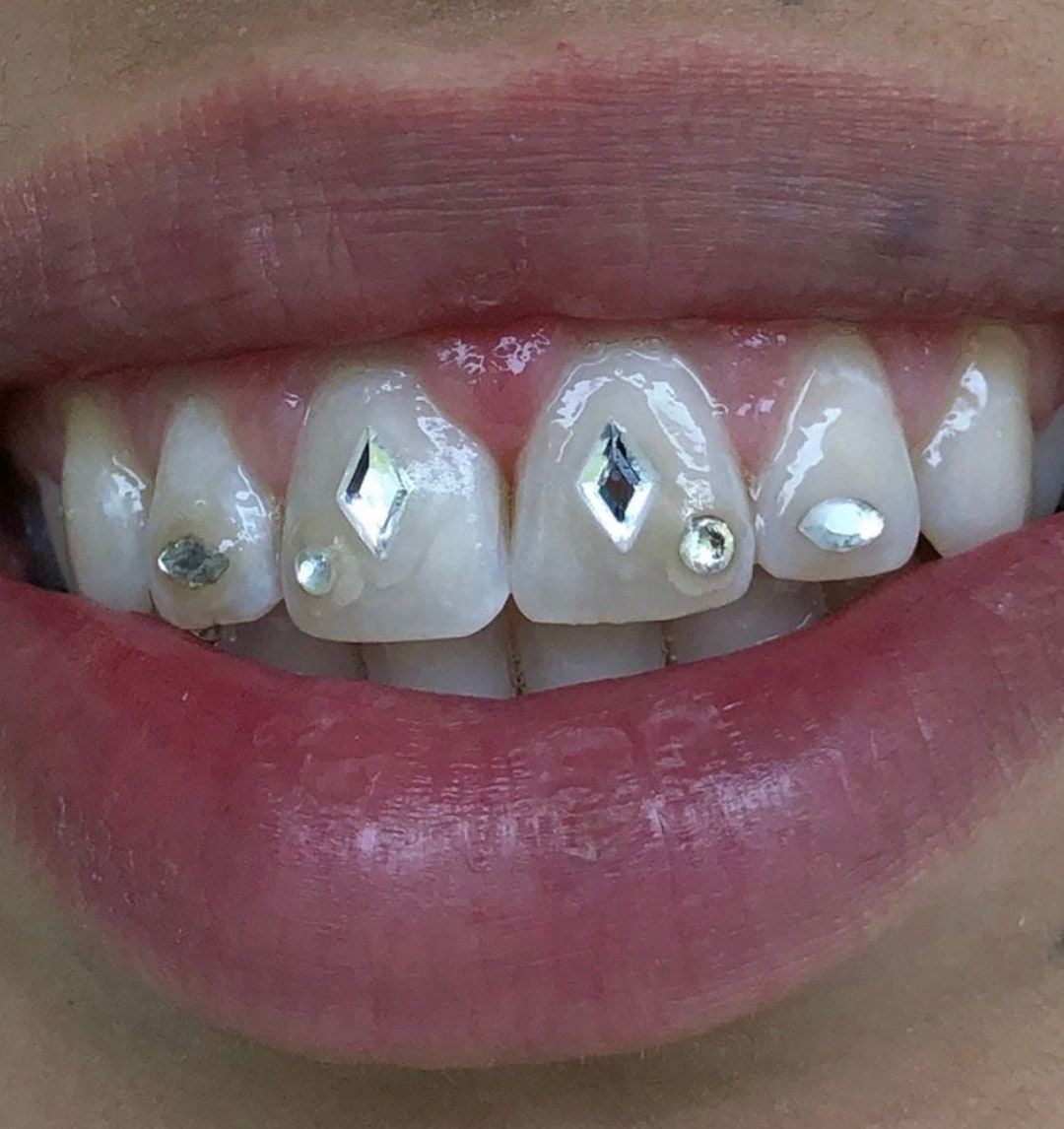 Dental Adhesive For Tooth Gems Diamond Kit Glue Teeth Crystal