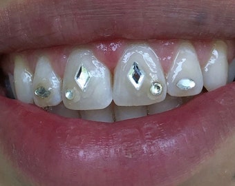 50 Piece Star Teeth Gems, Preciosa® Crystals, Lead Free Tooth Gems 