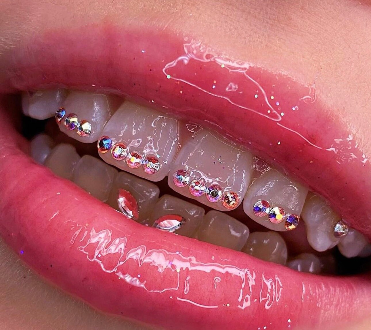 Tooth Gems Swarovski 