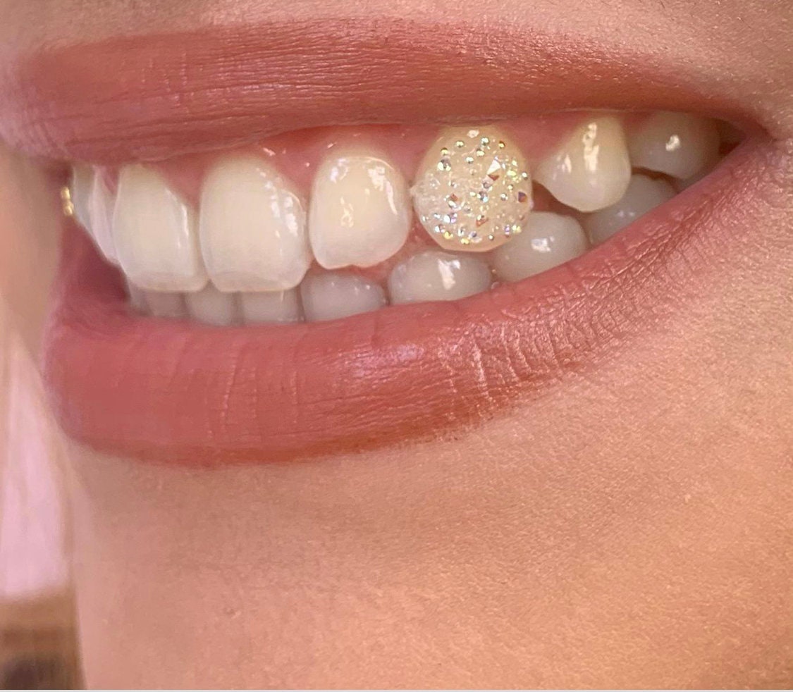 Diamond 2 Gold Tooth Gem