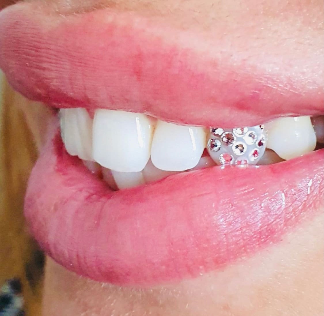 5x Tooth Gem Stones Top Quality Crystal Rhinestone Gems Glue
