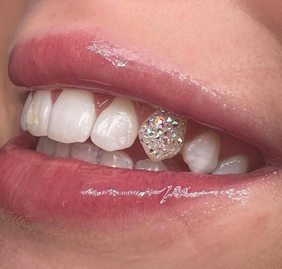 tooth teeth tooth gems Swarovski crystals ideas swag hype grillz