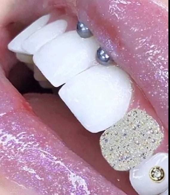 Diamond Gold Tooth Gems – BeDazzled Smilez