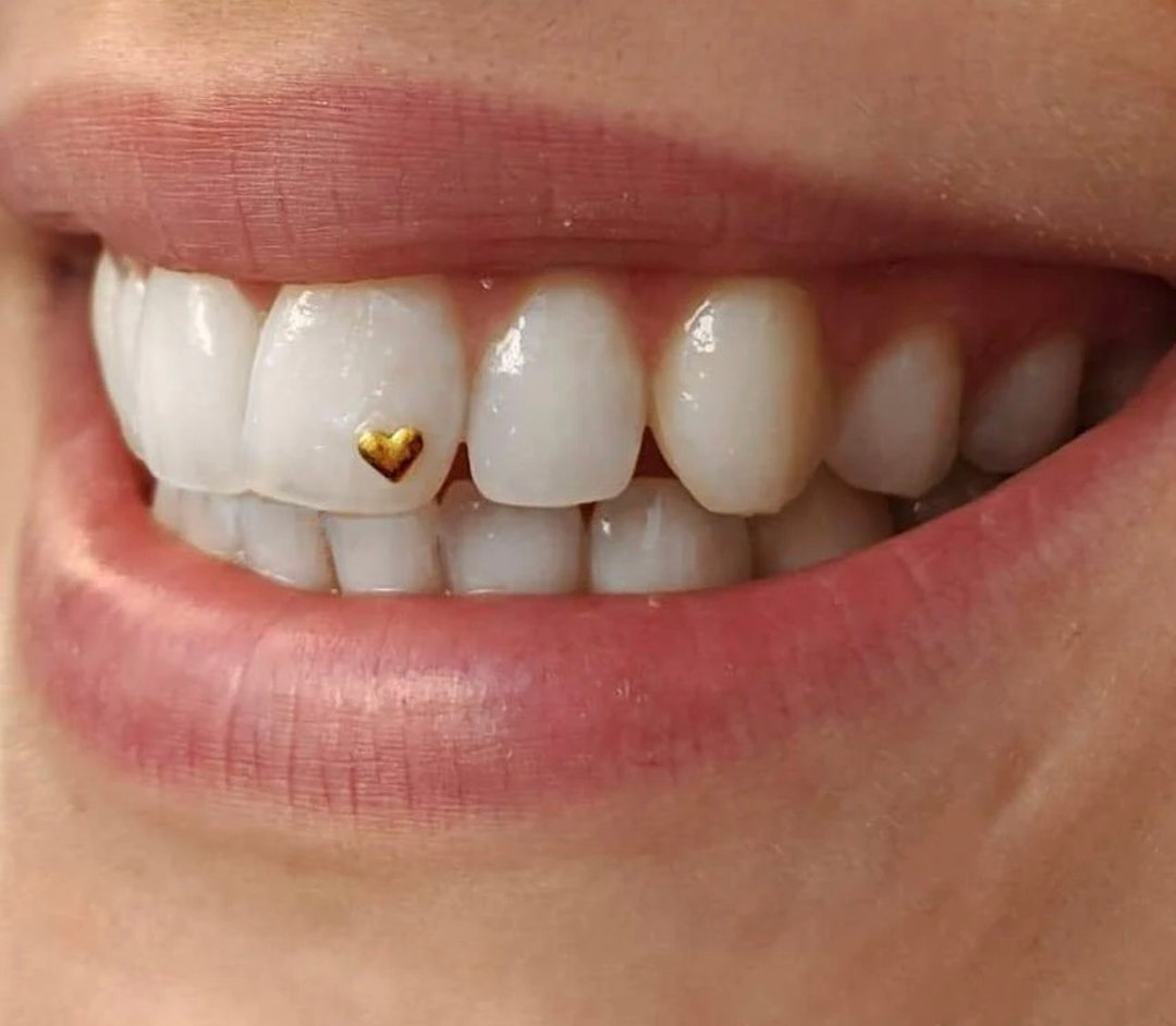 22k Gold Tooth Gems+Swarovski gem  Tooth gem, Diamond teeth, Gold teeth