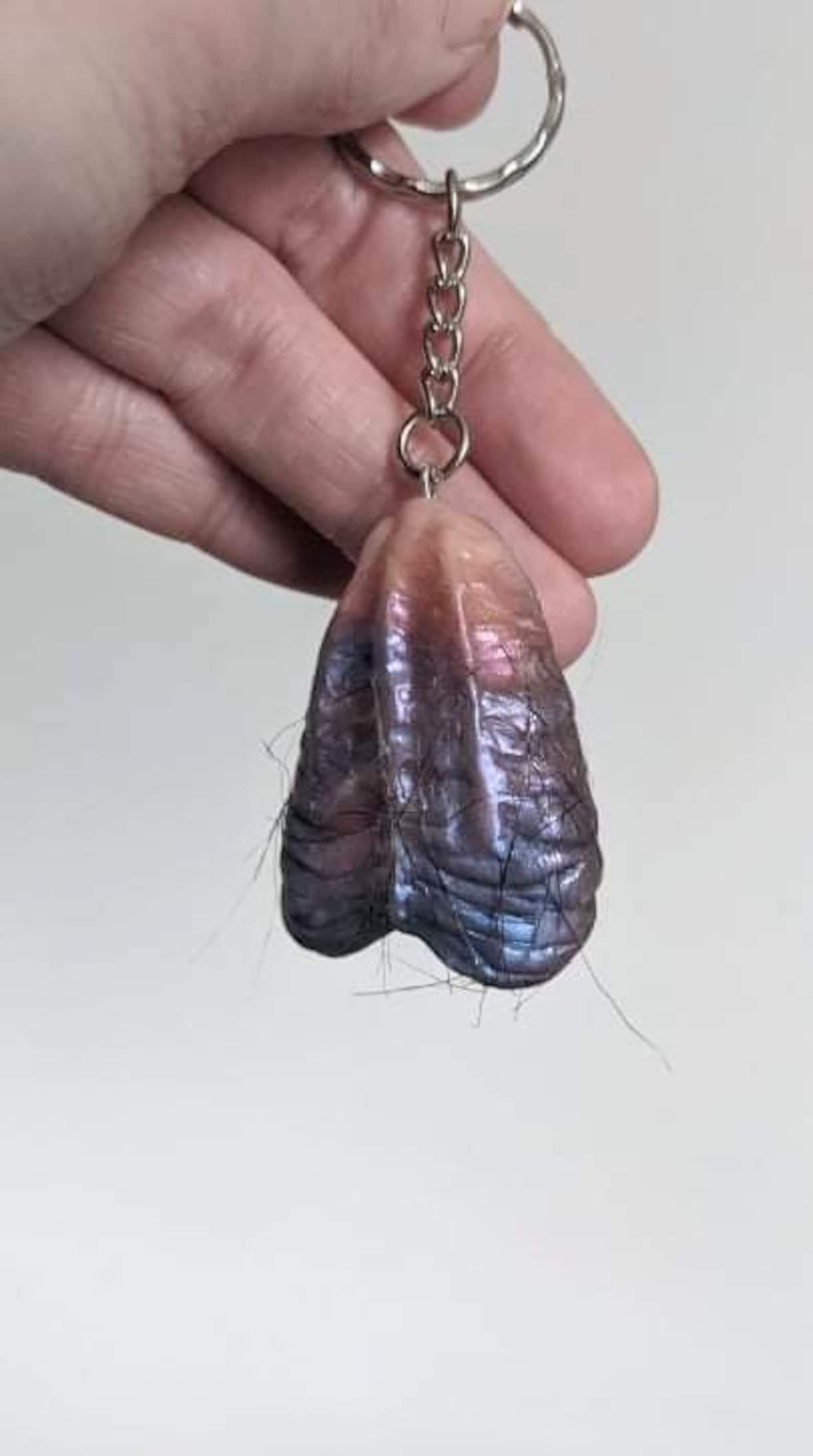 See Real Vasectomy Scars: Are Yours Normal? - abjt6h3
