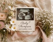 Neutral Floral Minimal Ultrasound Pregnancy Announcement, Editable Canva Template, Social Media Baby Reveal, Summer Reveal, Digital Download
