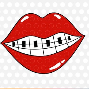 May include: Red lips with a white smile and black braces. The lips are outlined in black.