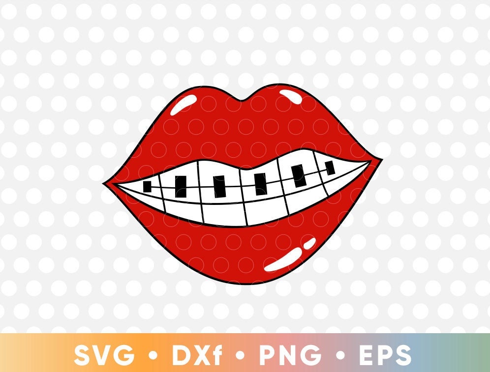 Smile With Braces - Etsy Smile With Braces - Etsy