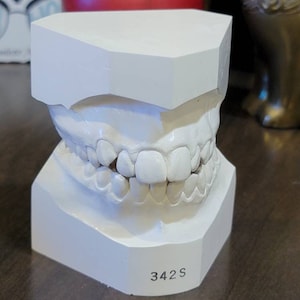 Vintage Dental Teeth Mold, Human Teeth, Creepy Halloween Prop